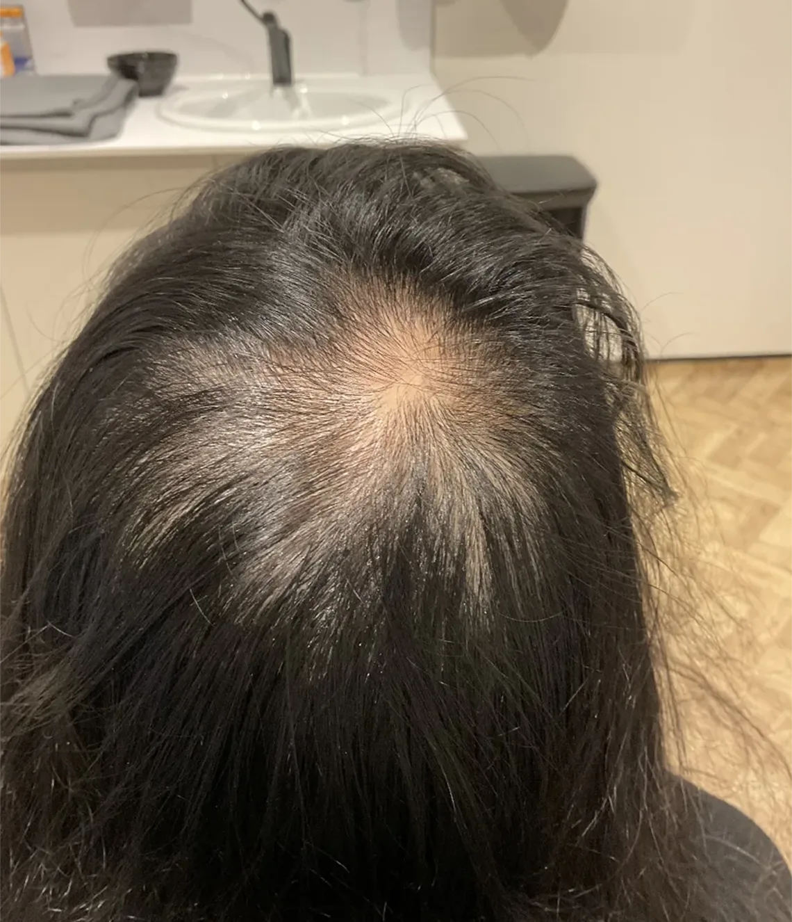 Before Treatment